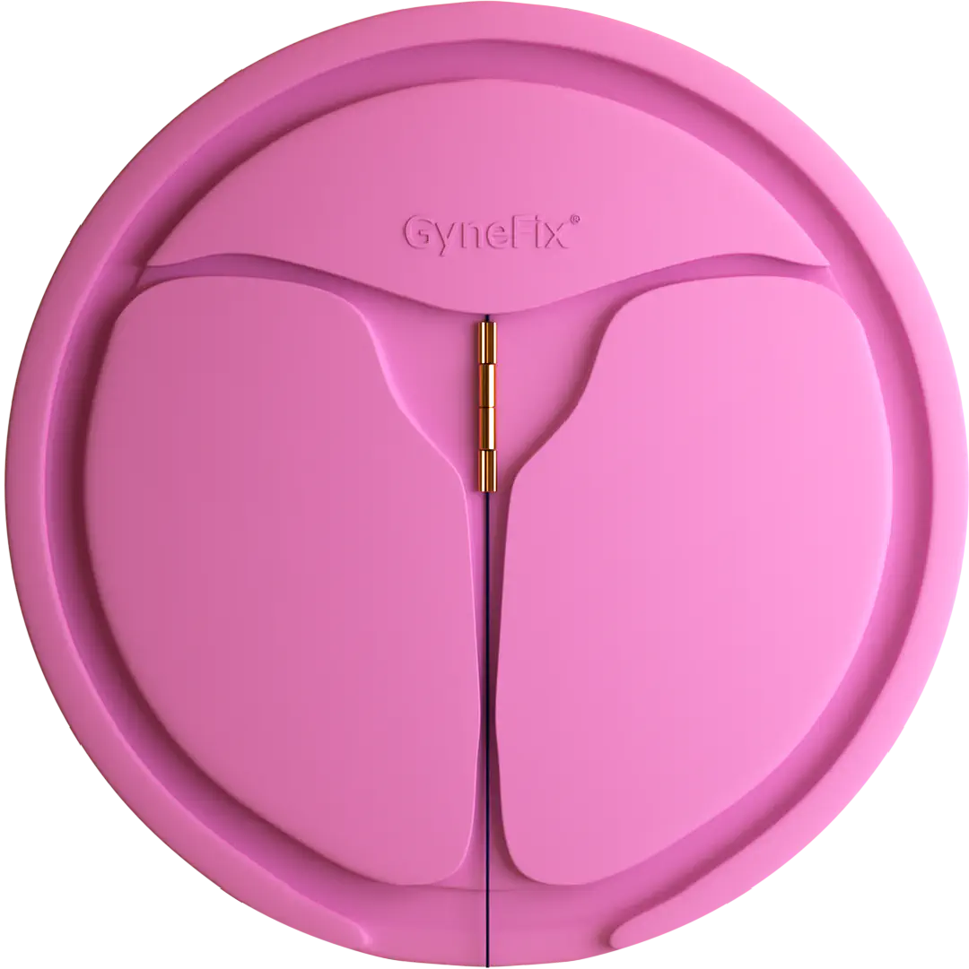 picture of gynefix in uterus